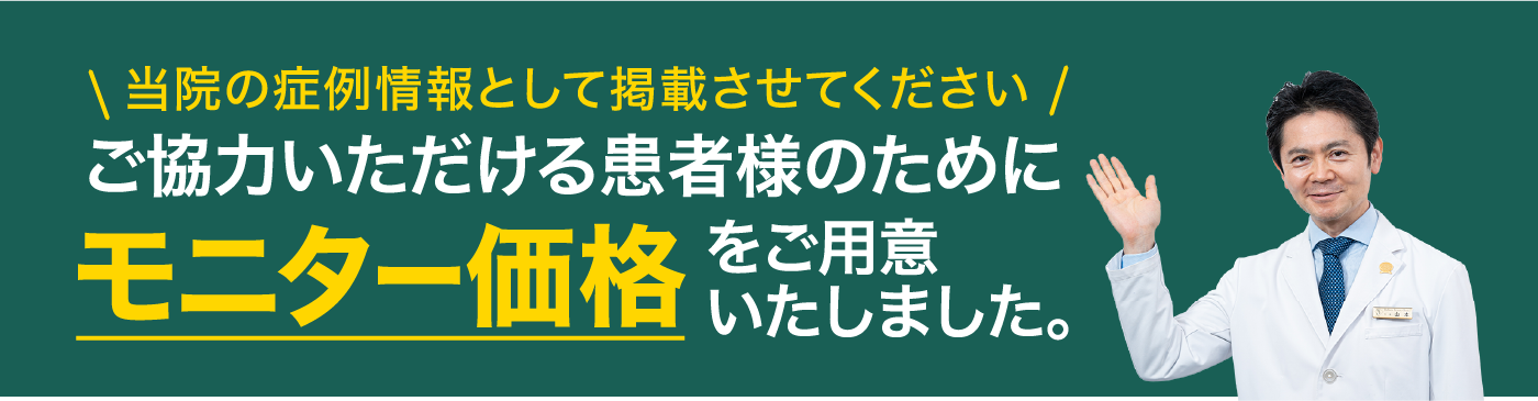 当院の症例情報として掲載にご協力いただける患者様のためにモニター価格をご用意いたしました。