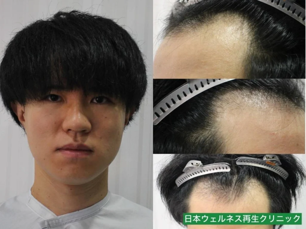 D・Kさんのオペ前