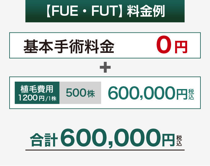FUE・FUTの料金例、500株の合計600,000円（税込）
