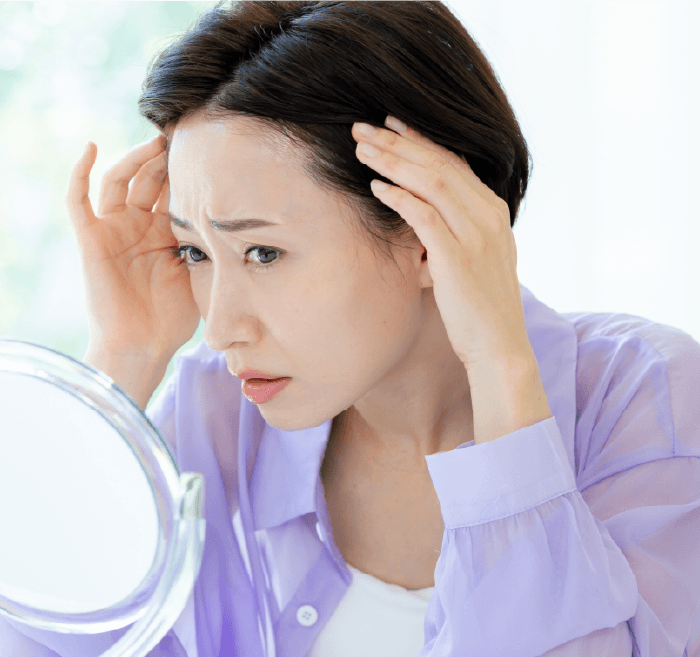 生え際の薄毛に悩む女性のイメージ